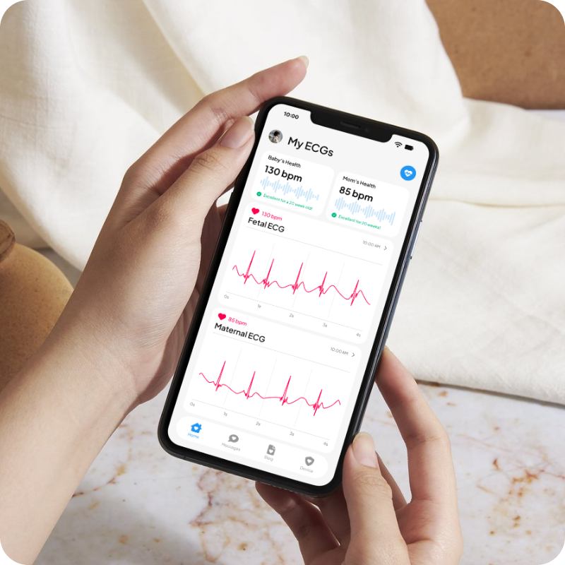 Hifi App Screen Mockup